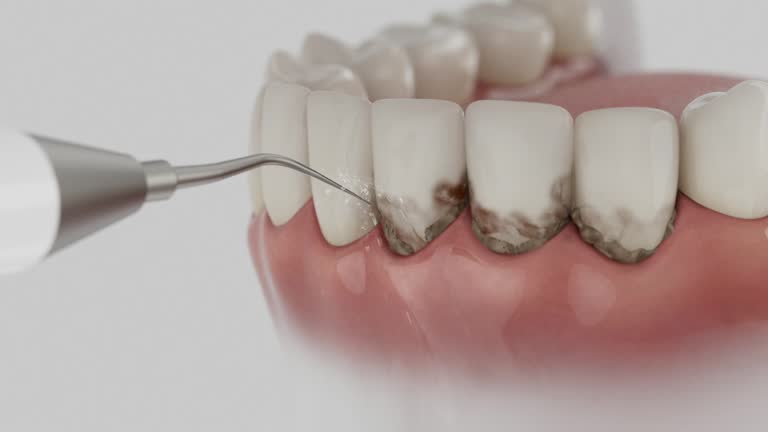 Reliable Emergency Dentist contractor in Fort Wright, KY by Smile Center Dentistry